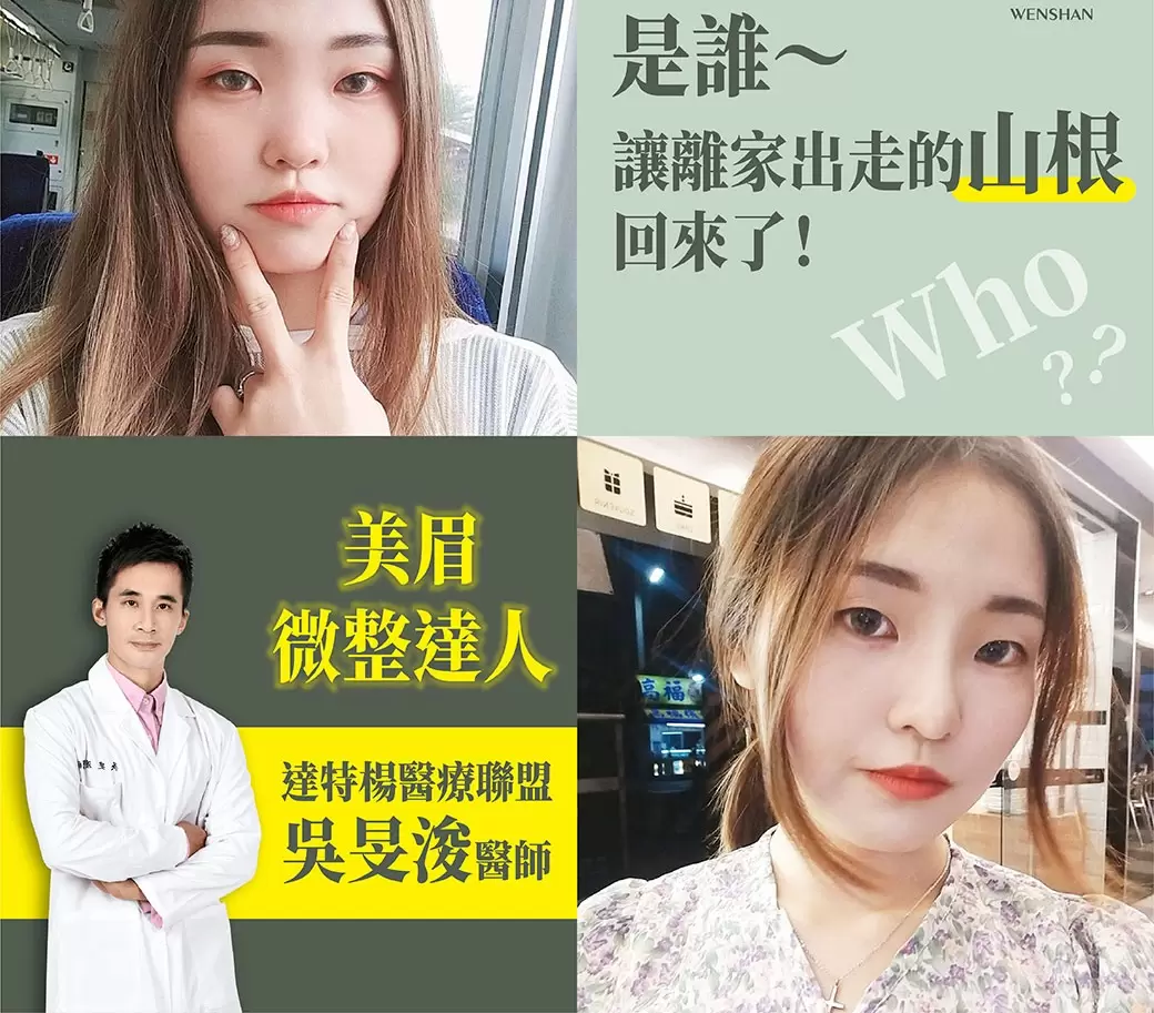 達特楊醫療聯盟【美眉微整達人 吳旻浚醫師】達特楊美學診所-2店報報