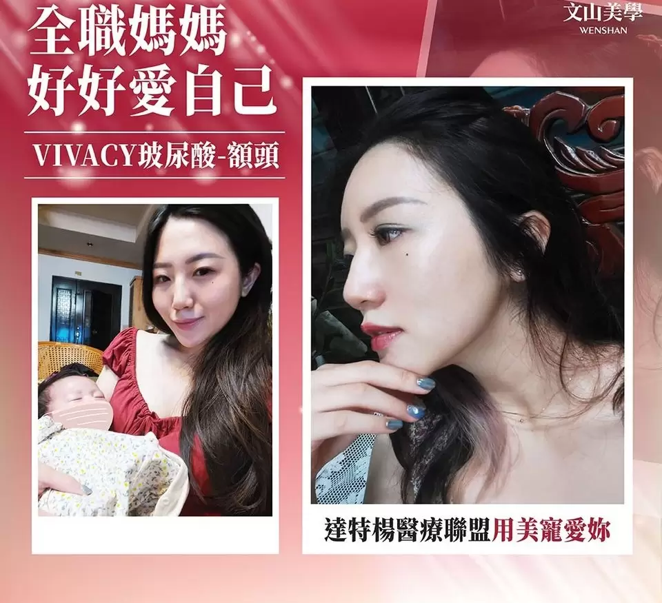 高雄微整形 達特楊醫療聯盟用美寵愛妳【全職媽媽好好愛自己】