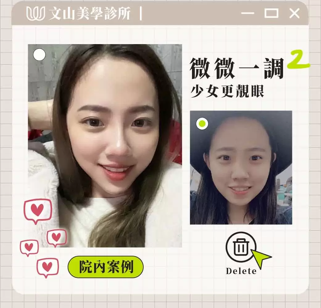 透過專業醫師建議，讓自己整體看起來更有精神更精緻