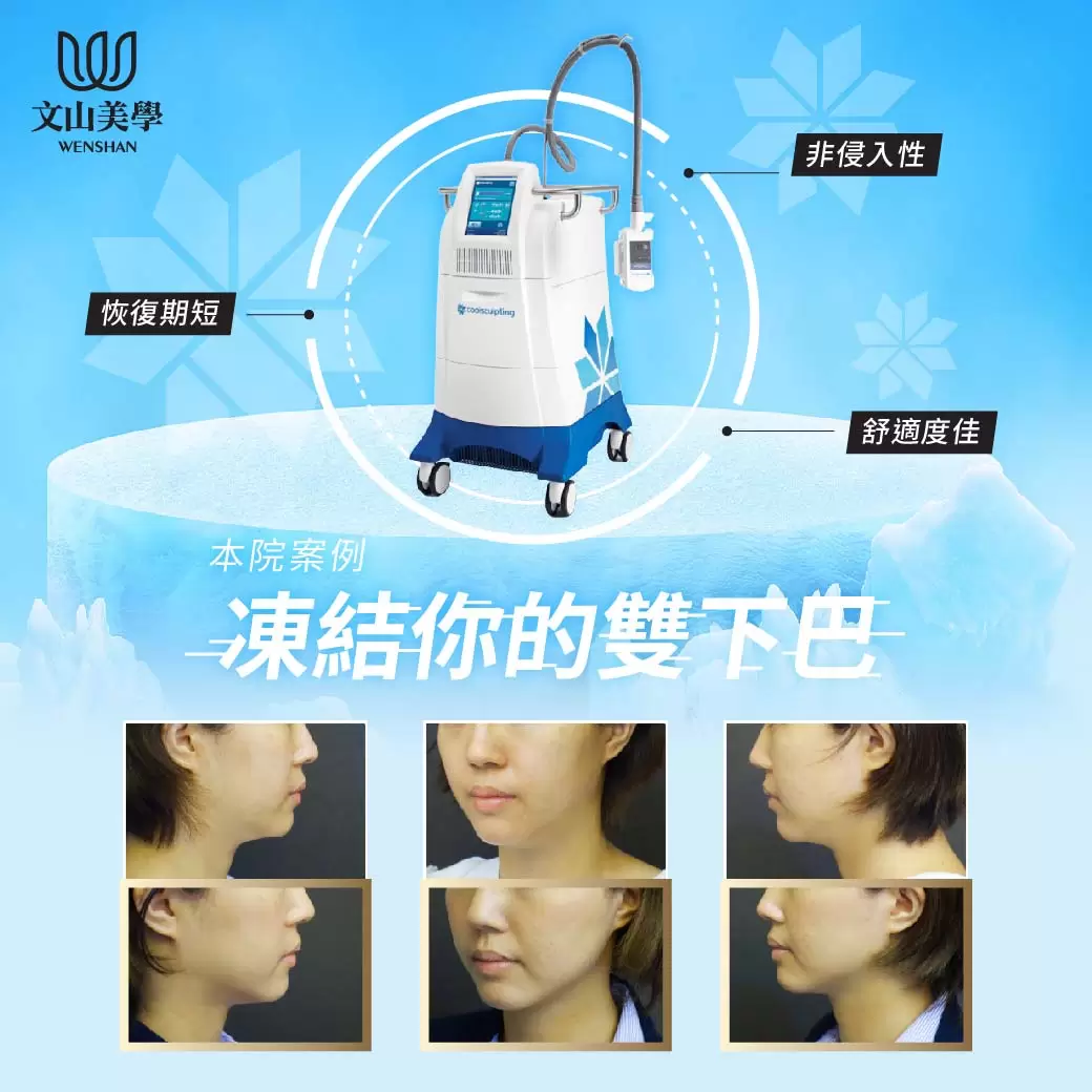 不痛痛脂肪飛～凍結你的雙下巴【酷塑低溫冷凍減脂】院內案例