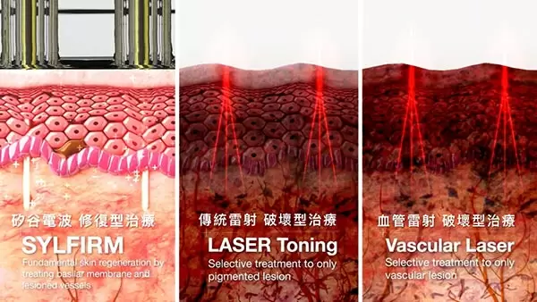 矽谷電波SYLFIRM 養膚新趨勢 重建皮膚生態系 打造不易長斑的健康膚質