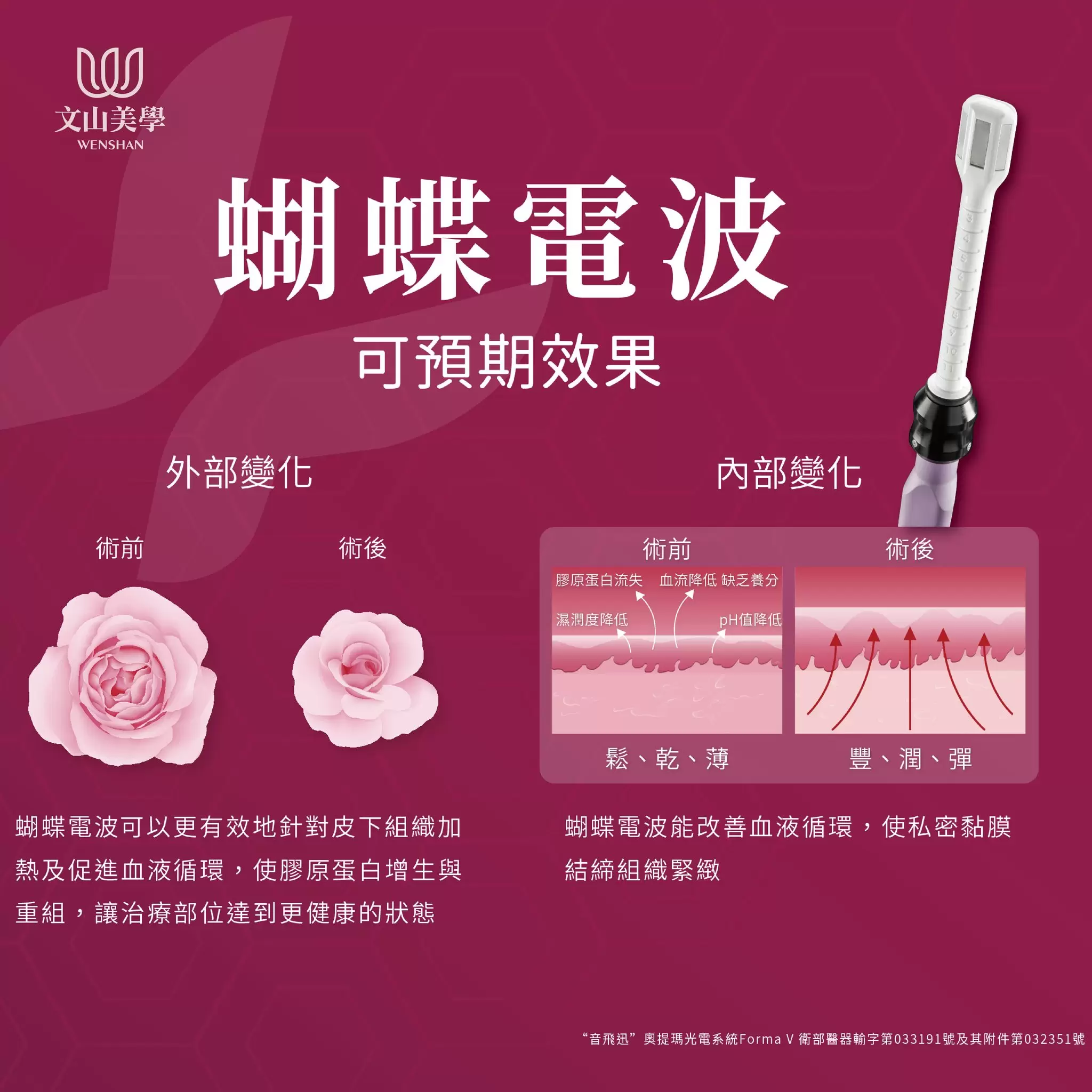 【蝴蝶電波 FORMA V 小教室】