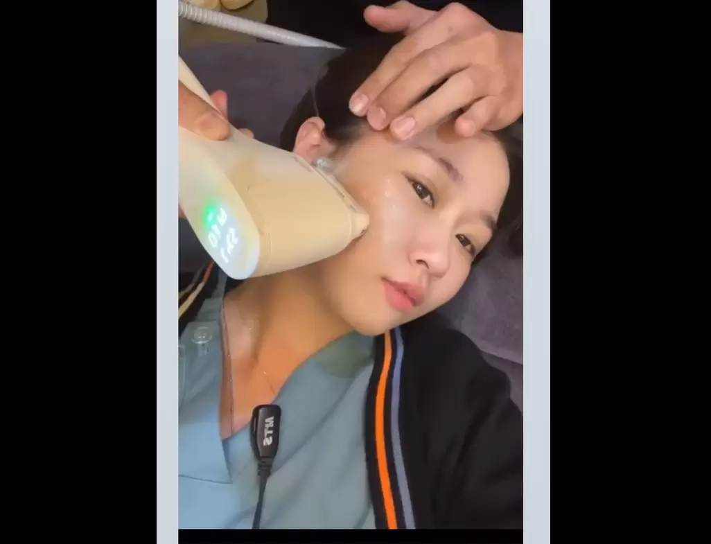 「Z音波LINEAR Z」Q+立線音波的升級版 改善臉部肌膚鬆、垮、垂等問題