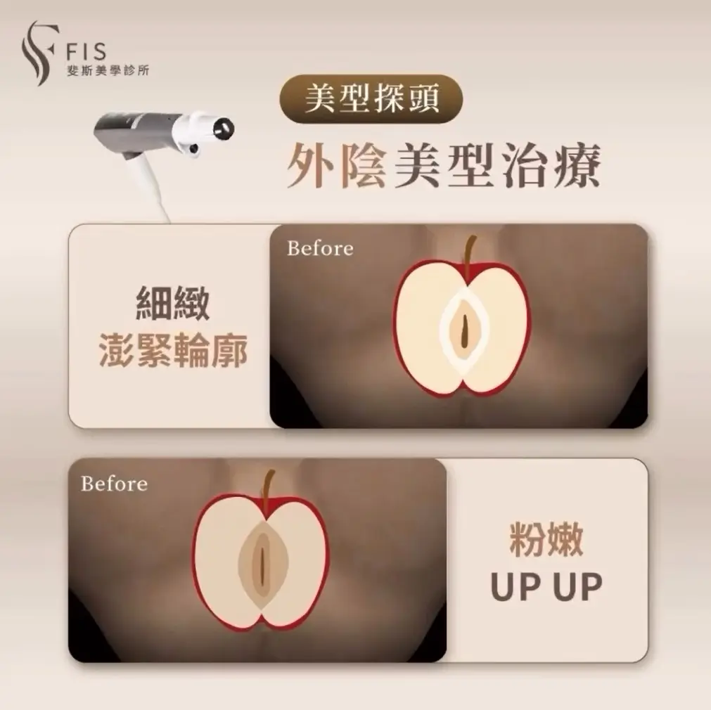 私密處健康澎潤緊蜜美型計畫｜閨蜜電波｜全方位保養不只做表面功夫