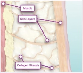 隨著年齡增長維持肌膚緊緻彈力的膠原蛋白會逐漸流失,高雄鳳凰電波,(俗稱)鳳凰電波thermage FLX&reg;療程