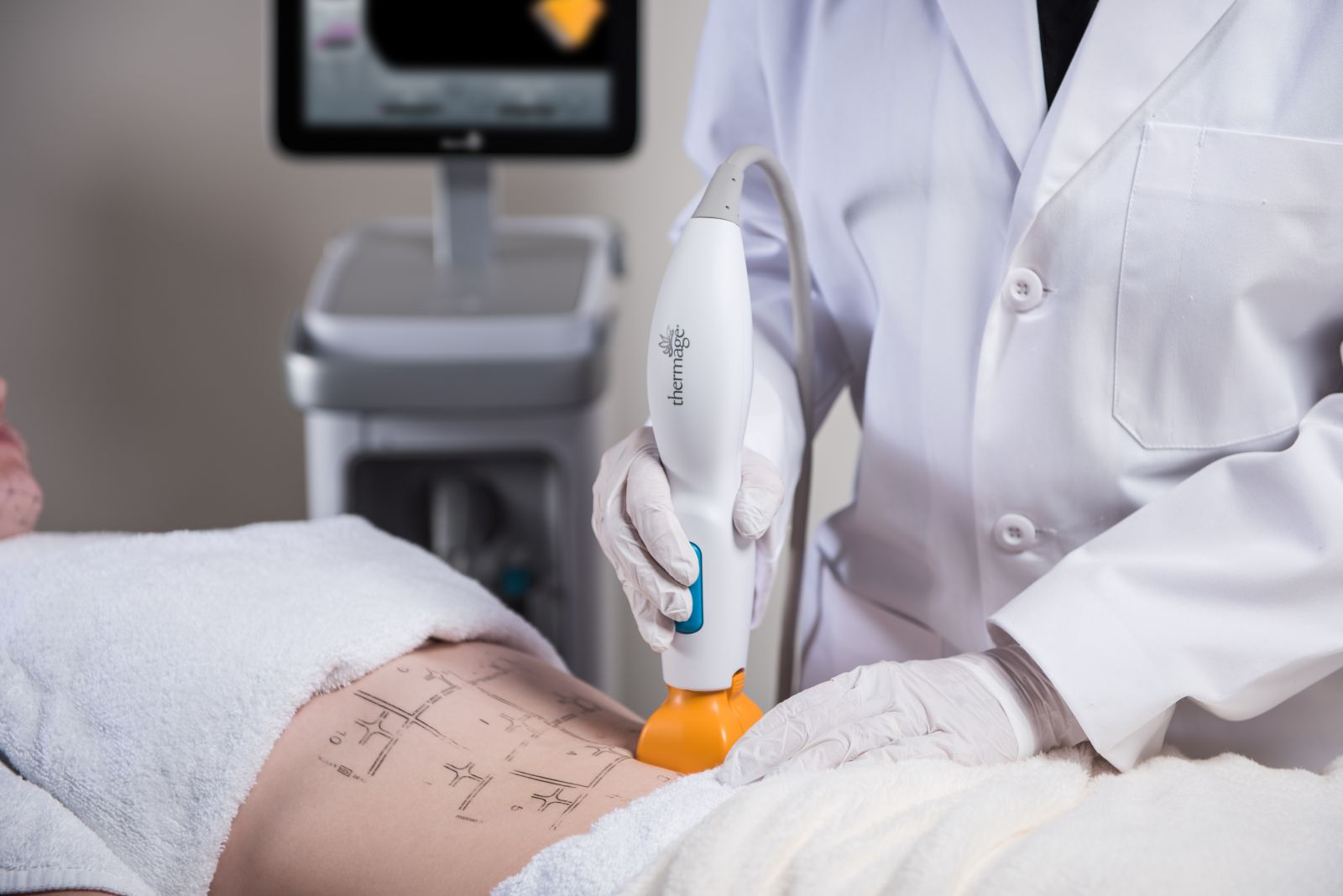 美體黃金探頭(身體),高雄(俗稱)鳳凰電波thermage FLX&reg;&ndash;非侵入式緊膚療程,改善身體鬆垮、有皺褶細紋的部位。